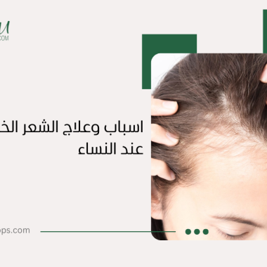 أسباب وعلاج الشعر الخفيف من الأمام عند النساء
